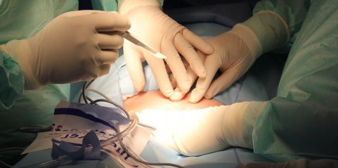 Número de cirurgias de ambulatório triplicou em 15 anos