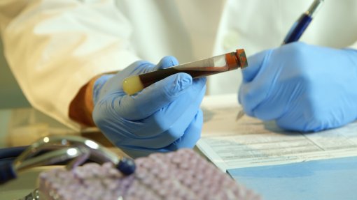 Infarmed alerta: Desapareceram 430 unidades de um potente analgésico