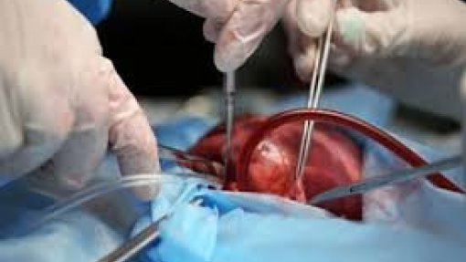 Hospital de Santa Marta já colocou &quot;corações artificiais&quot; em 15 crianças