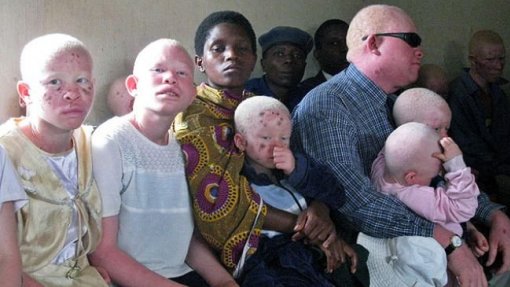 PALOP reforçam em Maputo papel de ativistas em prol de pessoas com albinismo