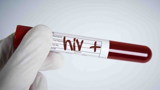 Número de novos casos de infeção por VIH diminuiu 46% entre 2008 e 2017