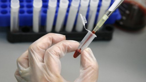 Cerca de mil pessoas estão a fazer profilaxia pré-exposição da infeção por VIH