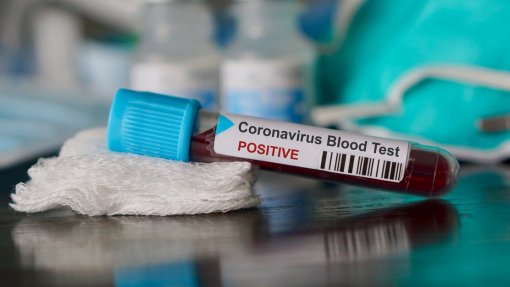 Covid-19: Pacientes em Guangdong que receberam alta voltaram a testar positivo