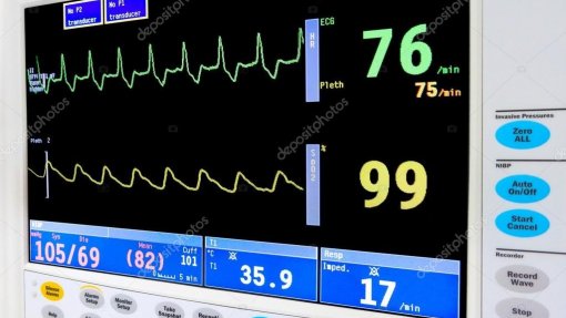 Covid-19: Galp oferece 29 ventiladores a hospitais públicos