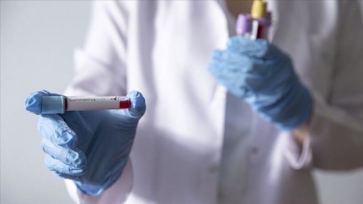 Covid-19: Vírus já matou 57 mil pessoas em mais de um milhão de infetados