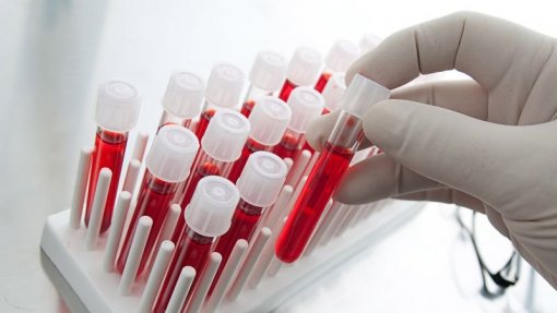 Covid-19: OMS aconselha prudência no uso de testes serológicos para concluir sobre imunidade