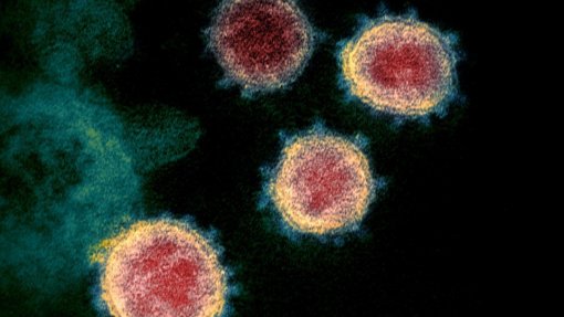 Covid-19: Investigadores criam plataforma para diminuir erros na deteção molecular do vírus
