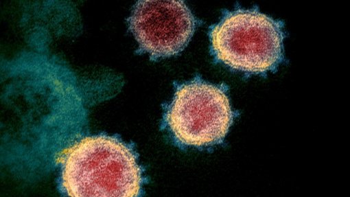 Covid-19: Investigadores criam plataforma para diminuir erros na deteção molecular do vírus