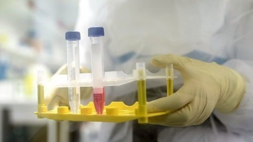 Covid-19: Polícia angolana avisa que vai recolher coercivamente quem foge aos testes