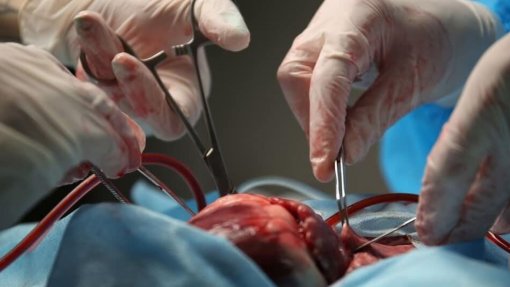 Covid-19: Primeiro trimestre de 2020 com mais transplantes apesar de quebra em março
