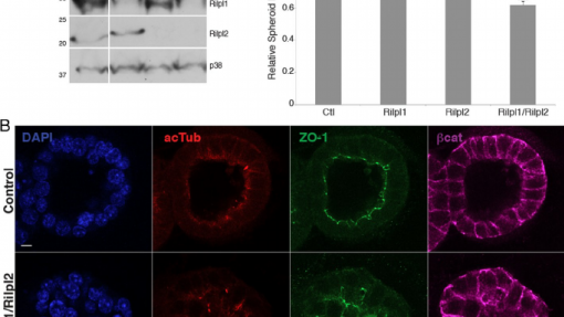 Cientistas desvendam papel de proteína que ajuda a perceber doenças neurodegenerativas