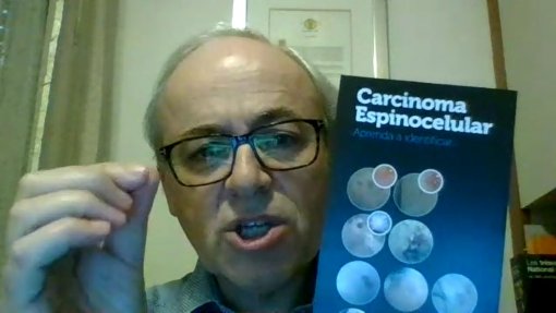“Não deixem para depois. Um diagnóstico tardio de um cancro de pele pode ser fatal”