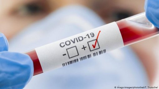 Covid-19: Portugal e Espanha juntam esforços em sensores da doença