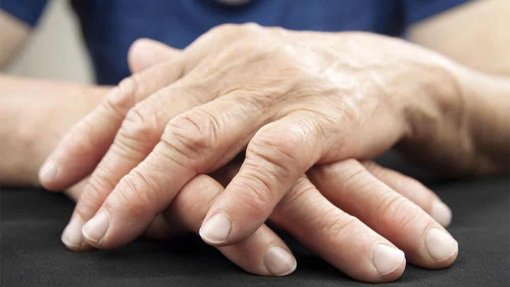 Muitos doentes com artrite reumatoide podem estar com medicação em excesso