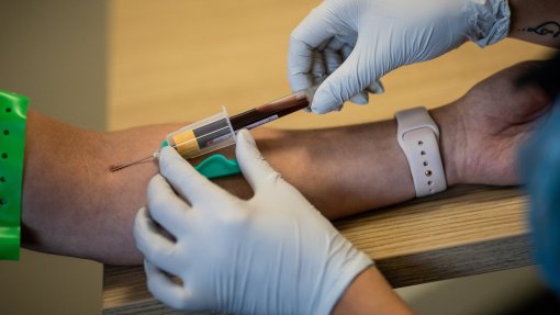 Portugal com 10.ª taxa de mortalidade por hepatite mais elevada da UE