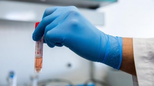 Covid-19: Mais de 17 milhões de casos registados a nível global
