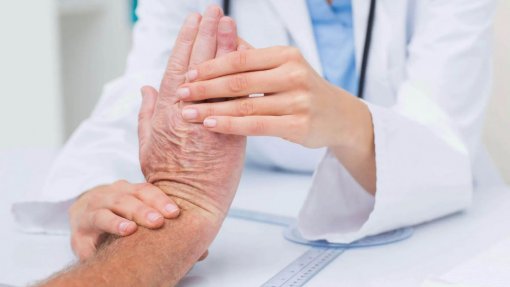 Reumatologistas acusam Governo de falta de planeamento e de não usar critérios técnicos