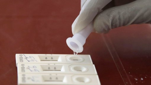 Covid-19: Testes rápidos podem ter fiabilidade de 95% se forem moleculares - Especialista