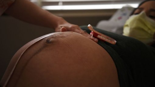 Covid-19: Maternidades devem ter testes rápidos e garantir acompanhante da grávida - parecer