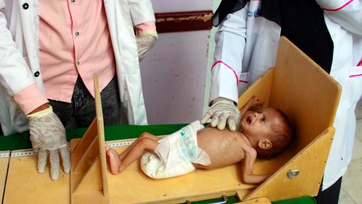 Covid-19: Doença pode aumentar em 132 milhões o número de pessoas com fome - ONU