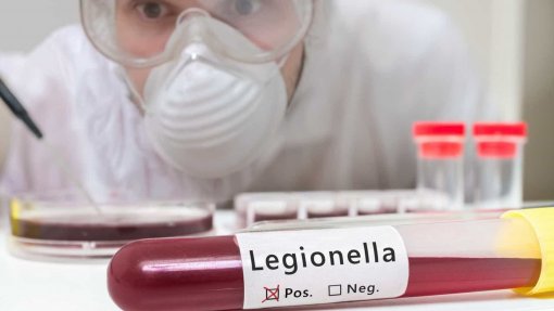 ‘Legionella’ causa mais uma morte no hospital da Póvoa de Varzim/Vila do Conde