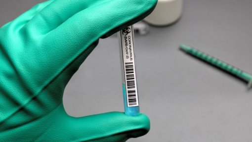 Covid-19: Guimarães começa a fazer testes rápidos de antigénio na próxima semana