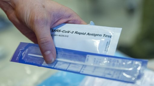 Covid-19: ARS-Norte recebeu 13.600 testes rápidos e já utilizou 132