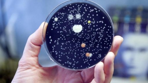 Número de internados devido a surto de ‘legionella’ no Grande Porto diminui