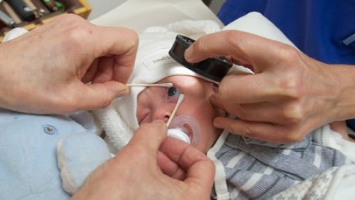Garcia de Orta realiza tratamento inovador para a retinopatia da prematuridade