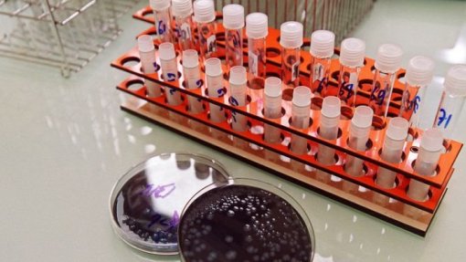 Dois novos casos de ‘legionella’ diagnosticados no Grande Porto