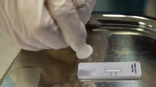 Covid-19: Quarenta mil testes rápidos realizados em 15 dias - DGS