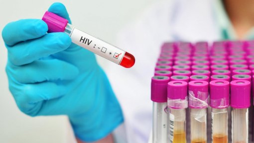 Covid-19: ONU alerta que pandemia agrava situação dos doentes com SIDA