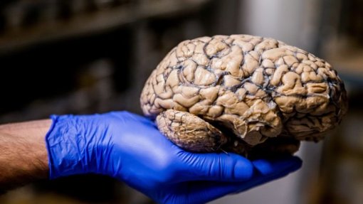 Cem instituições subscrevem declaração para investigação em neurociências mais justa e inclusiva