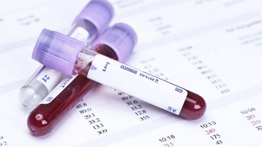 Glicose pode beneficiar tratamento do cancro com células imunitárias - estudo