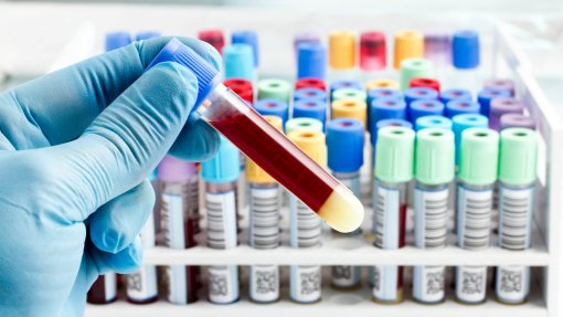 Hospitais com falta de anticorpos para uso terapêutico, alerta sociedade de Alergologia e Imunologia