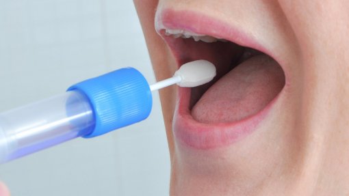 Covid-19: Universidade de Aveiro cria teste de saliva para substituir zaragatoa