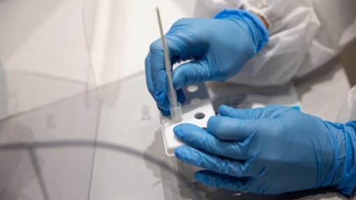 Covid-19: Apifarma garante que há capacidade para testagem sistemática no país