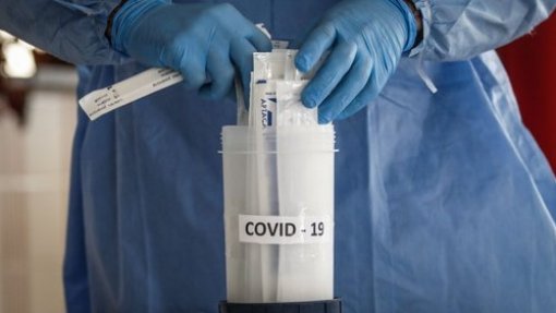Covid-19: Fevereiro regista média diária de 39 mil testes
