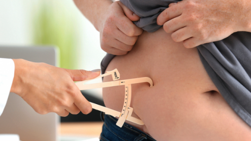 Associação dos Bariátricos alerta para a urgência de reforçar a reposta a doentes obesos