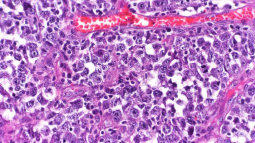 Universidade de Évora desenvolve moléculas para tratar vários tipos de cancro