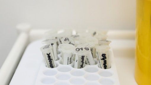 Covid-19: Projeto experimental indica ausência do vírus nos esgotos da Feira desde 05 de março