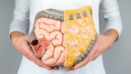 Sociedade Portuguesa lança petição para criar Dia da Síndrome do Intestino Irritável