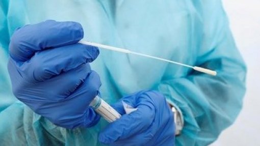 Covid-19: Madeira investe 3 ME em testes rápidos e avança com testagem massiva da população