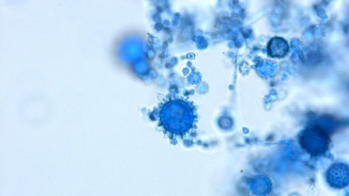 Fungo causa alta mortalidade em pessoas com HIV na amazónia brasileira