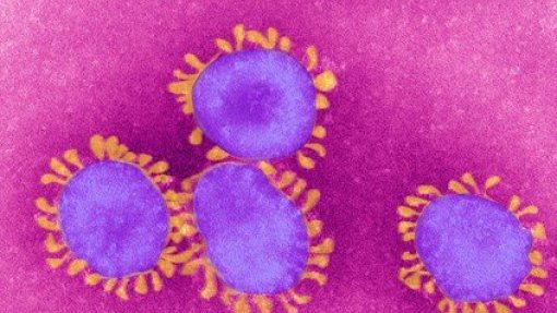 Covid-19: Não há motivo para preocupação acrescida com variante Delta Plus - investigador