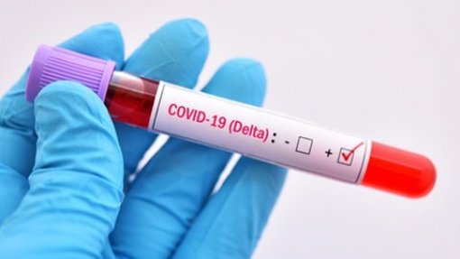 Covid-19: Açores com 51 novos casos de infeção e 26 recuperados