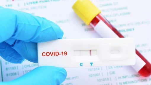 Covid-19: Governo aprova venda de autotestes rápidos em supermercados