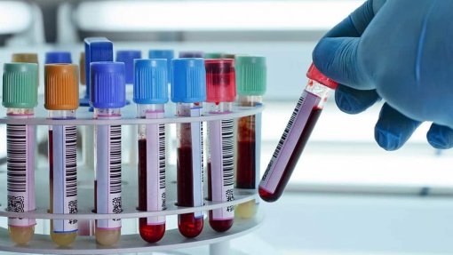 Covid-19: China promete analisar amostras de sangue anteriores ao surto em Wuhan