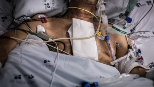 Covid-19: Quase 70% dos internados em UCI têm menos de 59 anos – Ordem dos Médicos