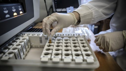 Covid-19: Variante Delta representa 98,6% dos casos